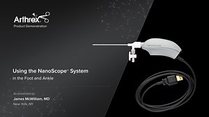 Using the NanoScope™ System in the Foot and Ankle