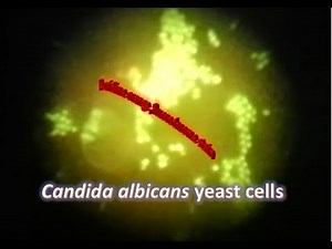 Candida albicans under Fluorescence microscope stained with Acridine Orange