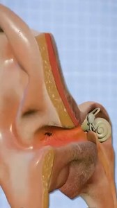 26K views · 64 reactions | Struggling to hear clearly? 僚 Try an online hearing test today! Early detection is key. Take the first step toward better hearing today. | Health Insights | Facebook