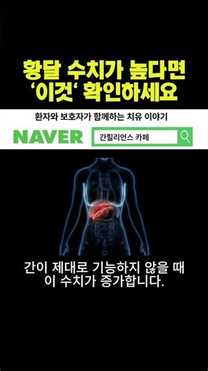 👆(Click) How to lower jaundice levels, a more important criterion than you think #shortsvideo #sh...