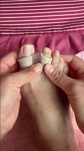 #Footcare #ToeSeparator #OverlappingToes #HalluxVariation