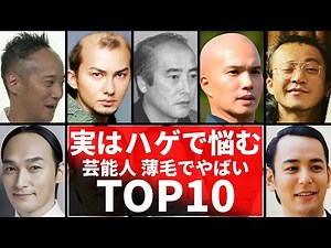 実はハゲ＆薄毛で悩む芸能人TOP10！驚愕の10人とは…あのイケメン俳優やアイドルまで…