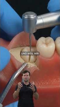🦷 How to remove an impacted wisdom tooth?