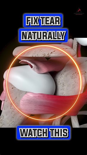 💥 Starting Rotator Cuff Rehab? Here’s Where to Begin 💥 Rotator cuff injuries don’t just need random strength—they need specific, strategic control right from the start. In early rehab, the goal isn’t max strength—it’s clean activation without stress on the joint. Here’s how to build the foundation: 🛠️ Internal Rotation Isometric Protects healing tissue while gently reactivating cuff muscles. Minimal joint movement, maximum stability work. 🎯 Dowel Flexion Assists safe shoulder elevation witho