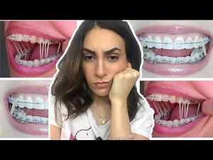 POURQUOI JE DOIS PORTER DES ELASTIQUES ??