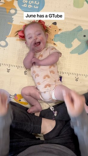 1.7M views · 15K reactions | This week is National Tube Feeding...