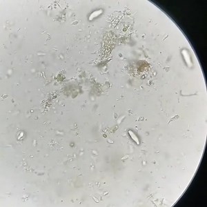 Stool sample 😲😍🔬 | Lab life