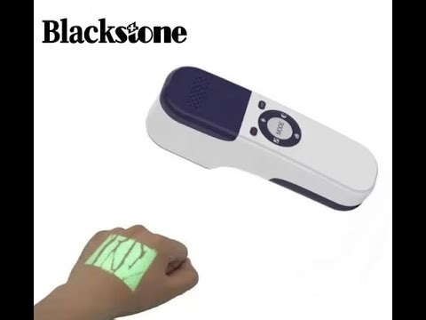 Advanced Infrared Vein Finder | High-Precision Visual Vein Locator