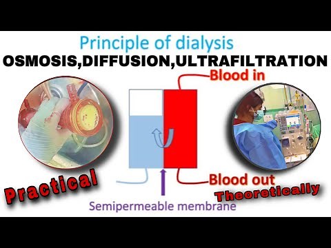 Principle of Hemodialysis | How Dialysis Works