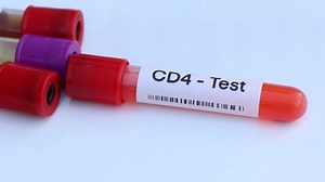 CD4-Test auf Blutanomalien, Blutprobe zur Analyse: Stockvideos & Filmmaterial (100 % lizenzfrei) 1097550949 | Shutterstock