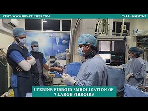 Uterine Fibroid Embolization: 7 Large Fibroids Treated by Dr. Sandeep Sharma