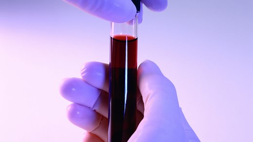 Want to learn more about your exposure to PFAS? Here are some resources for blood tests.