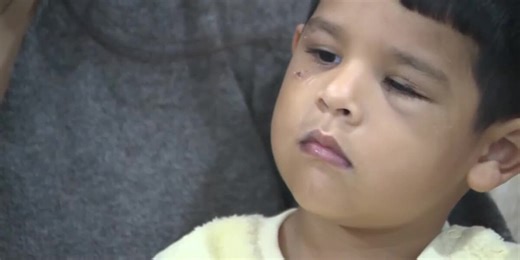 Family says neighbor’s loose dog ripped toddler’s teeth out during attack