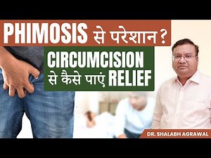 Adult Circumcision कब और क्यों जरूरी है? Health Benefits of Adult Circumcision | Dr Shalabh Agrawal