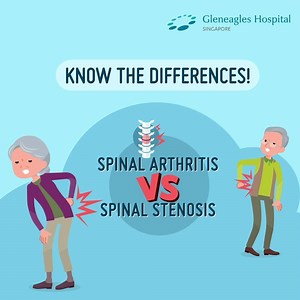 45 reactions · 22 shares | Back pain is a common symptoms of many spine problems. But do you know the difference between spinal arthritis or spinal stenosis? Watch the video to learn how to identify the different spinal degenerative conditions. Should you find that your spinal condition is worsening, do seek treatment early so that you can have a better tomorrow! Click "Book Now" to speak to our orthopaedic specialists today. #tomorrowmadebetter | Gleneagles Hospital, Singapore | Facebook
