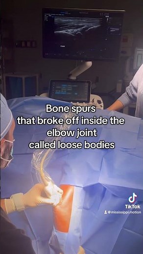 Tenex Bone Procedure for the Elbow #sportsmedicine #tenex #elbowpain #ultrasound