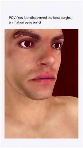 Tracheotomy Procedure Explain ⚡📍