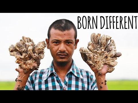 They Call Me 'The Tree Man' | BORN DIFFERENT