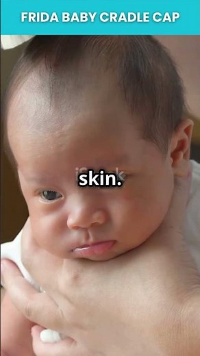 Frida Baby Cradle Cap Kit: Gentle & Effective for Baby’s Scalp! 👶✨
