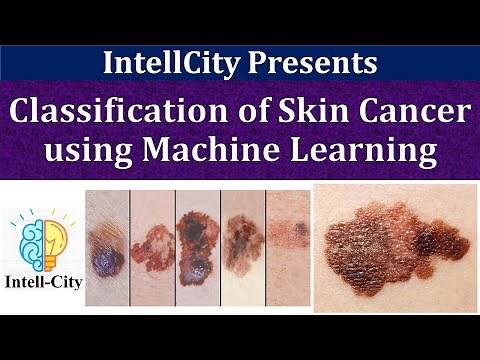 Machine Learning | Detection of Skin Cancer from Dermoscopic Images | Computer Vision