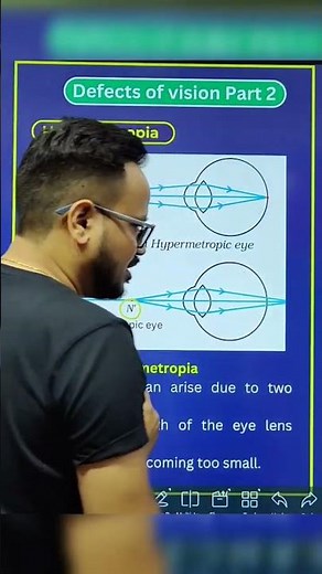 What is Hypermetropia - Causes and Correction #cbse2024 #class10science #cbseclass10 #10science