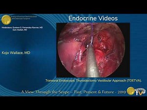Transoral Endoscopic Thyroidectomy Vestibular Approach (TOETVA). • Video • MEDtube.net