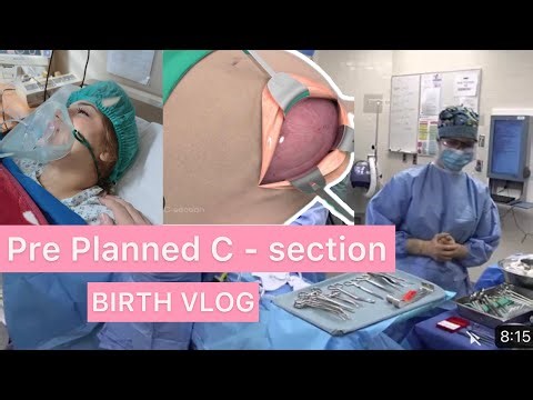 OFFICIAL BIRTH VLOG | PRE-SCHEDULED C-SECTION | what to expect ?