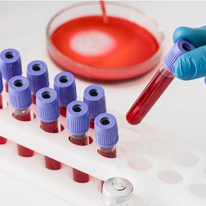 Diplomado en Toma y Conservación de Muestras de Laboratorio Clínico