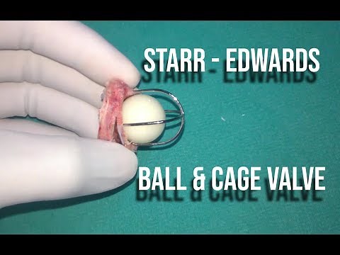 Starr Edwards Valve - First mechanical valve