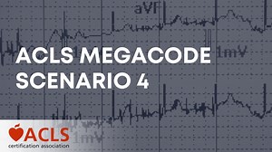 ACLS Megacode Scenario 4