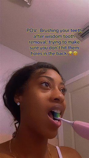 Brushing After Wisdom Teeth Removal: My 10-Day Journey