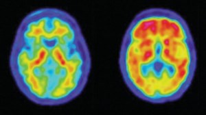 How do PET scans work?