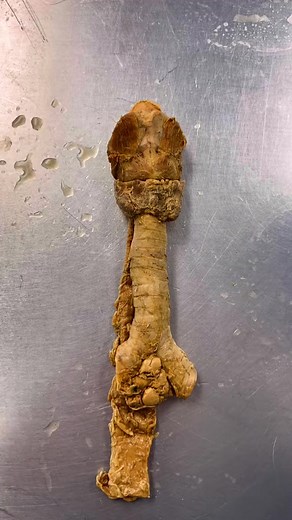 262K views · 5.2K reactions | Too much or too little T3/T4... Learn about Hypothyroidism and Hyperthyroidism  Be sure to like Institute of Human Anatomy for all the #anatomicalawesomeness易 | Institute of Human Anatomy | Facebook