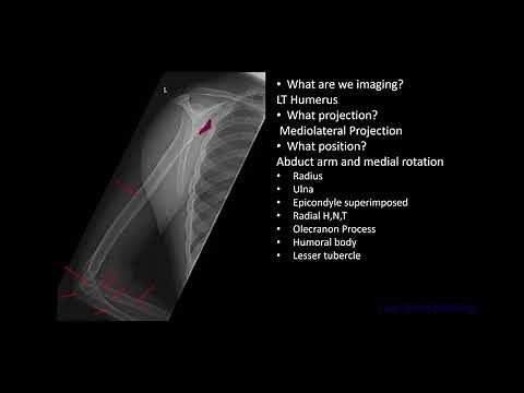 Positioning of the Humerus Episode 12 #LazyBonesRadiology