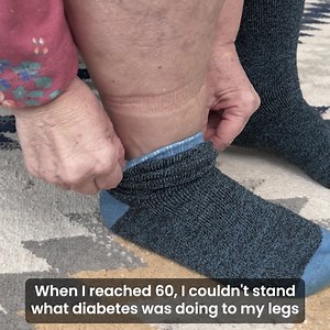 94K views · 5.8K reactions | Tired of Numb, Tingling Feet & Legs?...