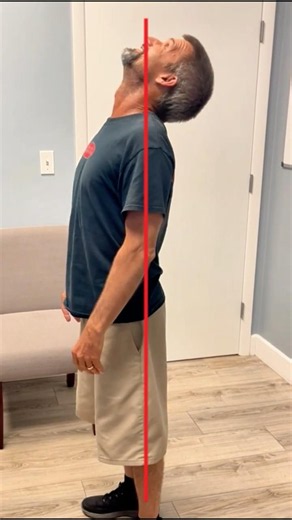 Over 20 Years of Back Pain Controlling his Life! DONT LET THIS BE YOU!