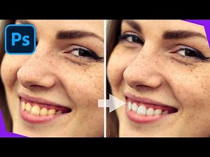 How To Whiten Teeth In Adobe PhotoShop