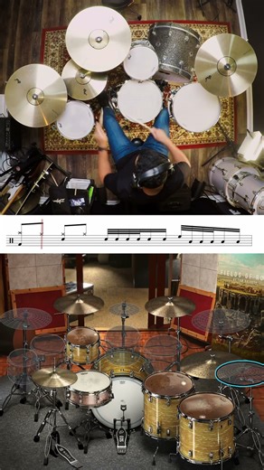 75 BPM Control Test — Fill #1