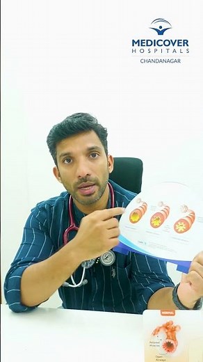 Understanding Asthma: A Simple Explanation | Medicover Hospitals