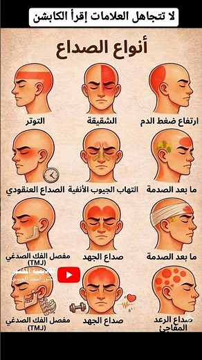 أ لأنواع الصداع، أسباب الصداع، أعراض الصداع، علاج الصداع، دليل طبي، الصداع بالصور تجده @doctor.amjed