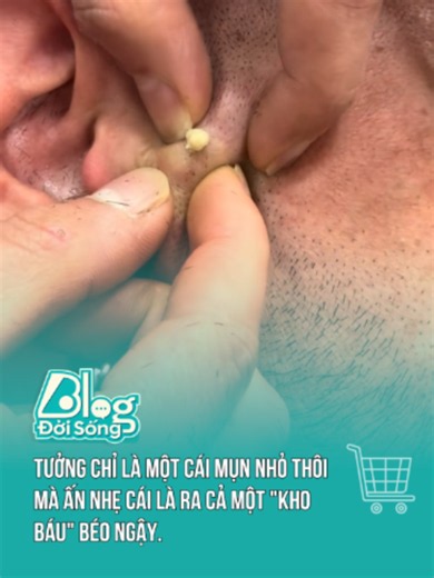 Bới vội tô cơm #doisong #trending #blogdoisong #btsmedia #blogtamsu #news #tiktoknews #viral #satisfying