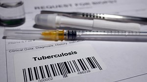 What you need to know about tuberculosis testing, vaccine longevity