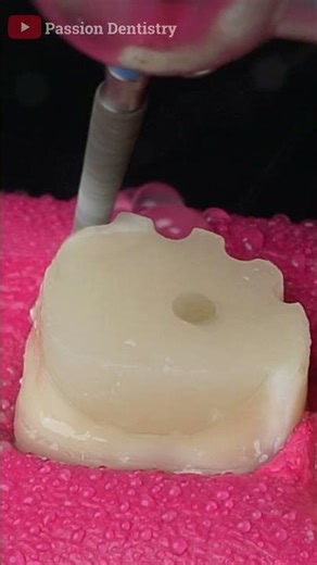 Capping The Tooth #crown #teeth #shorts