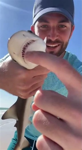 AMERICA NÃO É PARA INICIANTES 😳 HOMEM MOSTRA TUBARÃO QUE TENTOU MORDER SUA PERNA