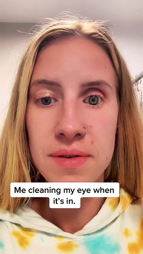 Effective Ways to Clean and Maintain Your Prosthetic Eye