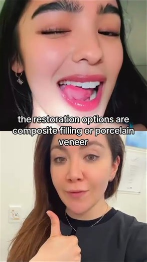 I Broke My Front Tooth, What Are The Options?!