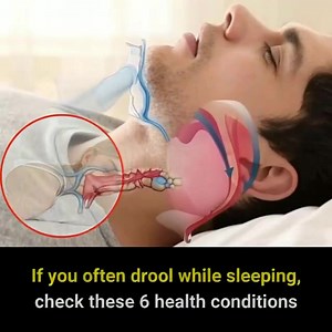 Drooling during sleep may seem like a harmless inconvenience, but it can be a sign of underlying health issues that need attention. If you frequently wake up to a wet pillow, it might be worth investigating these potential causes. | LikeNow