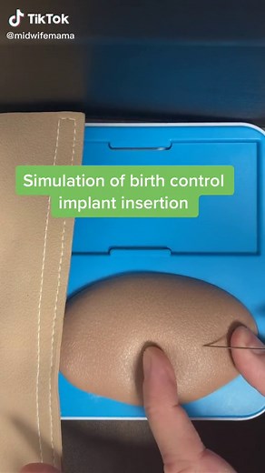 #birthcontrol #nursemidwife#megicine#obgyn#womenshealth #LegendaryChallenge #birthcontolcheck #healthyhabits6step