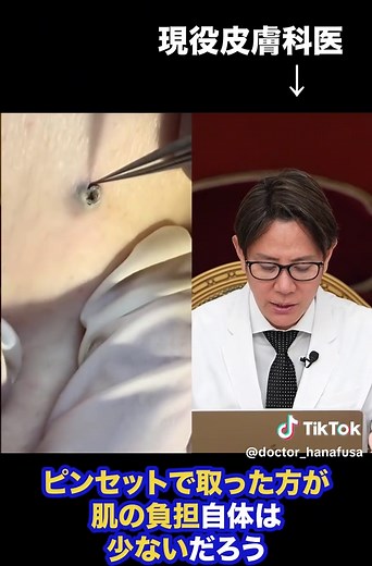 皮膚科医が教える角栓のピンセットテクニック