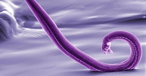 Scientists complete first map of an animal's nervous system in "major milestone"